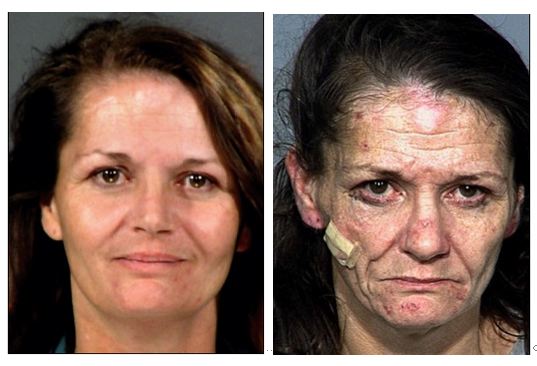 meth-before-after.jpg